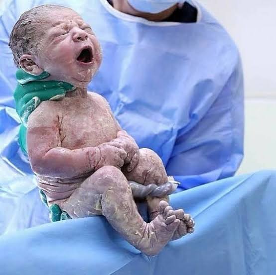 الطبقة البيضاء على بشرة المولود لا تنظيفها فورا